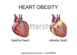 Cardiovascular Diabetology, Obesity and Stroke Photo