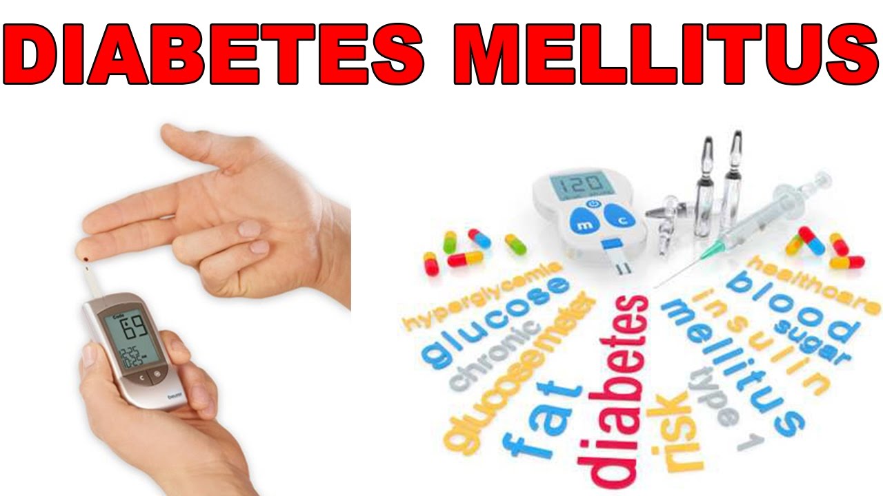 Diabetes Mellitus An Overview Diagnosis And Tests