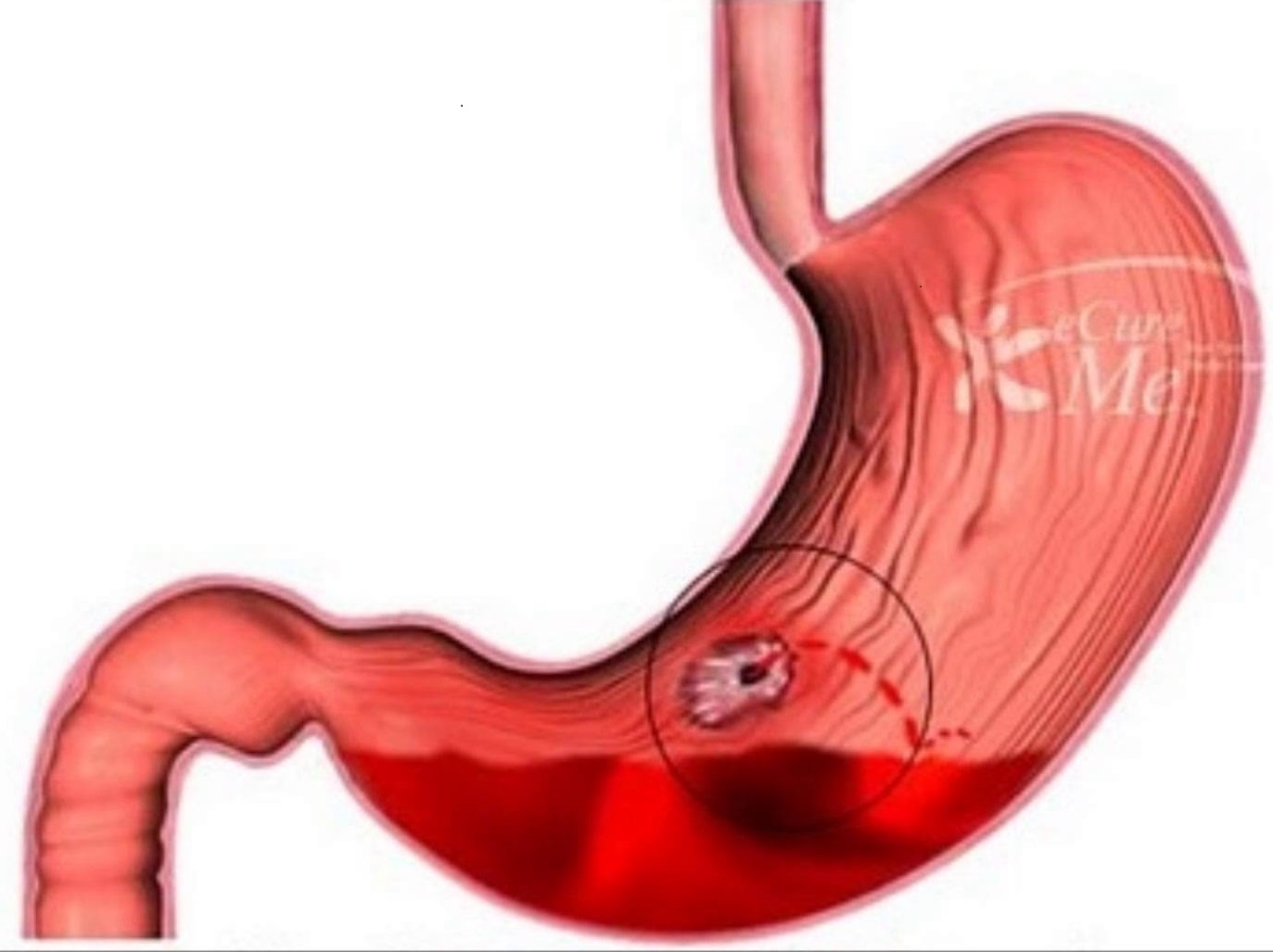 gastrointestinal-tract-definition-anatomy-infection-diseases