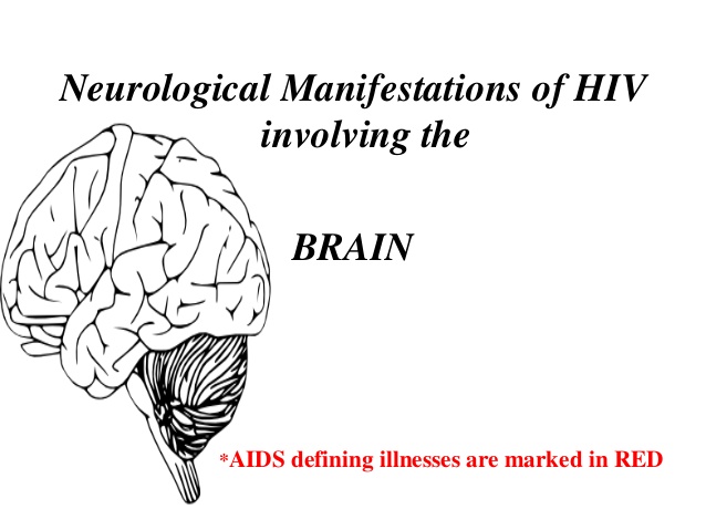 Neurological manifestation on HIV/AIDS Photo